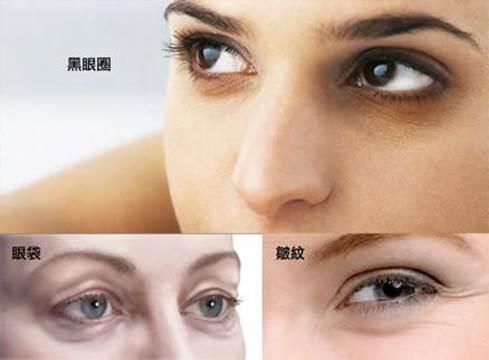 如何去眼袋和黑眼圈，揭曉什么眼霜去眼袋黑眼圈效果最好