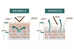 夏季油光?。苛智遘幧讲杌櫮w油來幫忙