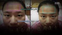 朵妍清祖傳中藥面膜 祛斑價格西紅柿祛斑的小竅門面部黃褐斑