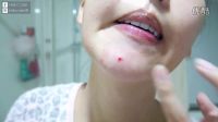 【怎么擠痘不留疤】中國夢想秀 男女糾察隊 錢塘老娘舅 我們相愛吧